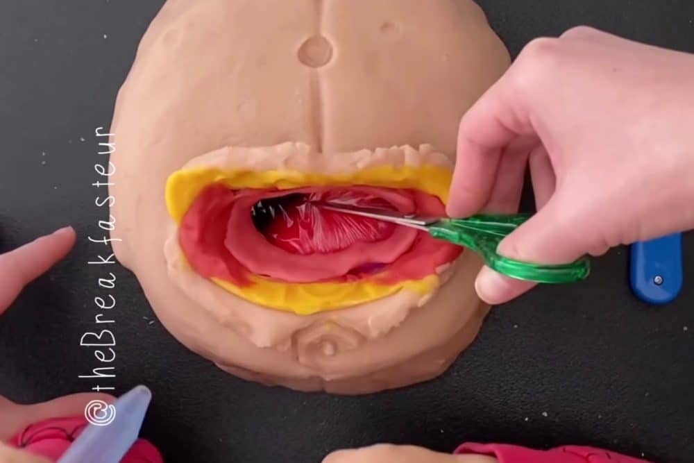 mom-dragged-for-using-play-doh-to-demonstrate-c-section-surgery-to-son